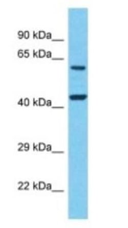 Leukotriene B4 Receptor 2 Rabbit anti-Human, Polyclonal, Novus Biologicals:Antibodies:Primary